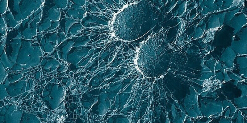 bild staphylococcus-aureus